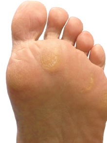 足底筋膜炎の足底の機能