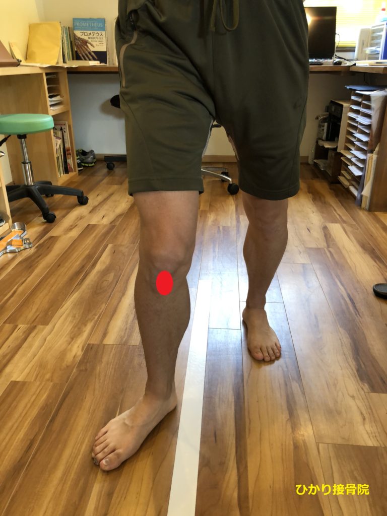 足底筋膜炎の膝の評価